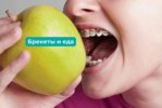 Как правильно питаться во время коррекции прикуса брекетами